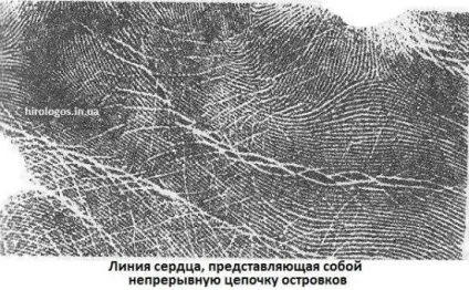Пляма, острівці на лінії серця (серця) Пляма, острівці на лінії серця