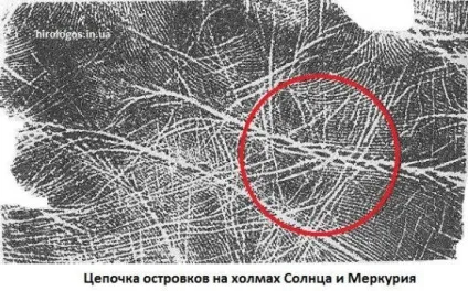 Пляма, острівці на лінії серця (початок лінії серця Бірла) Пляма, острівці на лінії серця