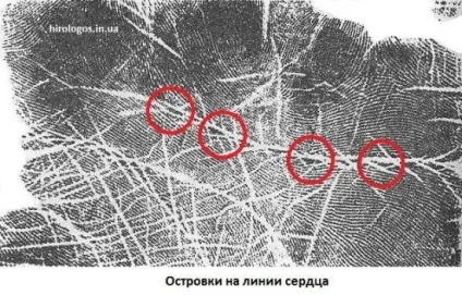Пляма, острівці на лінії серця (пляма) Пляма, острівці на лінії серця