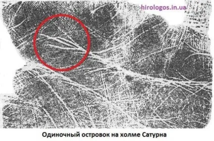 Пляма, острівці на лінії серця (початок лінії серця Бірла) Пляма, острівці на лінії серця