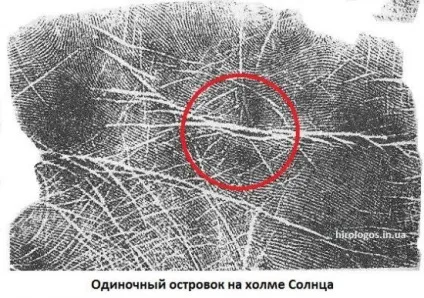 Пляма, острівці на лінії серця (пляма) Пляма, острівці на лінії серця