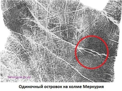 Пляма, острівці на лінії серця (початок лінії серця Бірла) Пляма, острівці на лінії серця