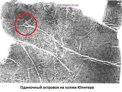 Пляма, острівці на лінії серця (пляма) Пляма, острівці на лінії серця