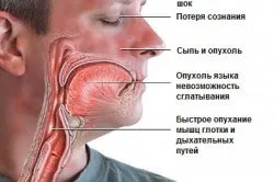 Рідкісні і алкоголь сумісність зі спиртним, взаємодія в організмі (спиртним) Рідкісні і алкоголь сумісність зі спиртним, взаємодія в організмі
