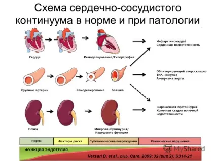 Ремоделювання міокарда та його ознаки (ремоделювання) Ремоделювання міокарда та його ознаки