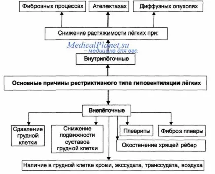 Рестриктивний тип альвеолярної гіповентиляції (рестриктивний) Рестриктивний тип альвеолярної гіповентиляції