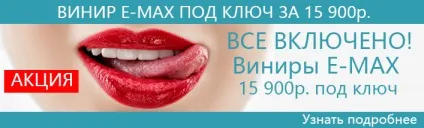 Зробити голлівудські вініри на зуби, ціна в Москві, фото, скільки коштує голлівудська усмішка (зробити) Зробити голлівудські вініри на зуби, ціна в Москві, фото, скільки коштує голлівудська усмішка