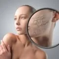 Лущиться голова у грудничка лущення шкіри немовляти (лущиться) Лущиться голова у грудничка лущення шкіри немовляти