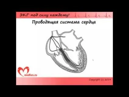 Синдром Фредеріка на ЕКГ симптоми і ознаки (синдром) Синдром Фредеріка на ЕКГ симптоми і ознаки