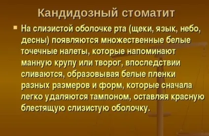 Стоматит мовою у дитини як лікувати в домашніх умовах (лікувати) Стоматит мовою у дитини як лікувати в домашніх умовах