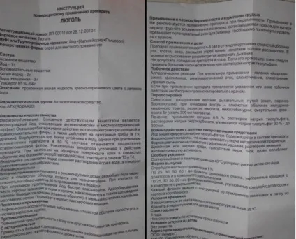 Стоматит мовою у дитини як лікувати в домашніх умовах (стоматит) Стоматит мовою у дитини як лікувати в домашніх умовах