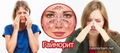 Таблетки від гаймориту список