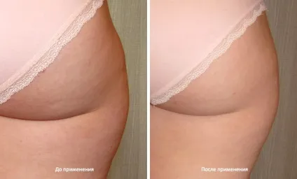 Тест-драйв антицеллюлитной косметики geomar (тест драйв) Тест-драйв антицеллюлитной косметики geomar