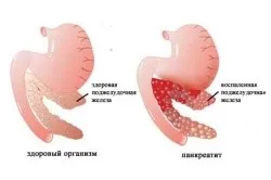 Нудота на голодний шлунок причини (ентерологіі будинку) Нудота на голодний шлунок причини