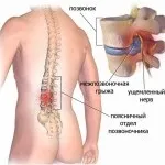 Вправи для постави в домашніх умовах випрямлення у дітей і дорослих (вирівнювання постави в домашніх умовах) Вправи для постави в домашніх умовах випрямлення у дітей і дорослих