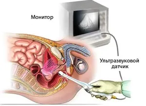 Ультразвукове дослідження (УЗД) чоловічих статевих органів (ультразвукове) Ультразвукове дослідження (УЗД) чоловічих статевих органів