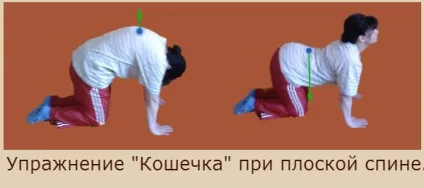 Вправи при плоскій спині, лікувальна фізкультура (вправи) Вправи при плоскій спині, лікувальна фізкультура