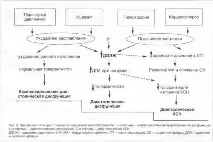 Терапія-знайомтеся диастолическая серцева недостатність - медична енциклопедія (недостатність) Терапія-знайомтеся диастолическая серцева недостатність - медична енциклопедія