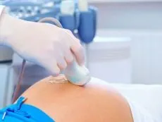 Видно чи ДЦП на узі при вагітності, чи можна визначити у плода (плоду) Видно чи ДЦП на узі при вагітності, чи можна визначити у плода