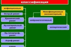 Вірусний риніт симптоми