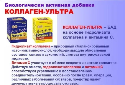Вітаміни для зміцнення суглобів і кісток, хрящів, м'язів і зв'язок назви елементів і комплексів (хрящів) Вітаміни для зміцнення суглобів і кісток, хрящів, м'язів і зв'язок назви елементів і комплексів