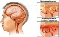 Питання чим небезпечна гонорея