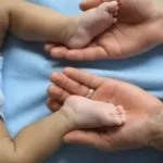 Природжений вивих тазостегнового суглоба причини, клінічна симптоматика, діагностика, лікування (вивих) Природжений вивих тазостегнового суглоба причини, клінічна симптоматика, діагностика, лікування