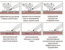 Здоров'я під контролем апарат для ультразвукової чистки обличчя gezatone bio sonic 3003d (gezatone) Здоров'я під контролем апарат для ультразвукової чистки обличчя gezatone bio sonic 3003d
