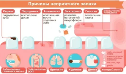 Запах між зубами і від ясен (ясен) Запах між зубами і від ясен