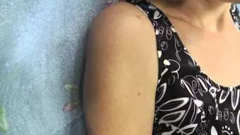 Жовті плями на тілі 1 (червоні жовтуватим відтінком) Жовті плями на тілі 1