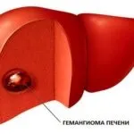 Трахеостомия у дітей, журнал медичних статей «молодий лікар» (перешийка щитовидної залози) Трахеостомия у дітей, журнал медичних статей «молодий лікар»