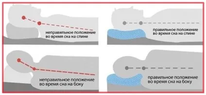 Вчимося спати правильно при остеохандрозе