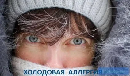 Алергія на холод причини появи і ознаки (шкіра) Алергія на холод причини появи і ознаки