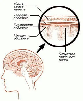 Арахноидит симптоми, лікування
