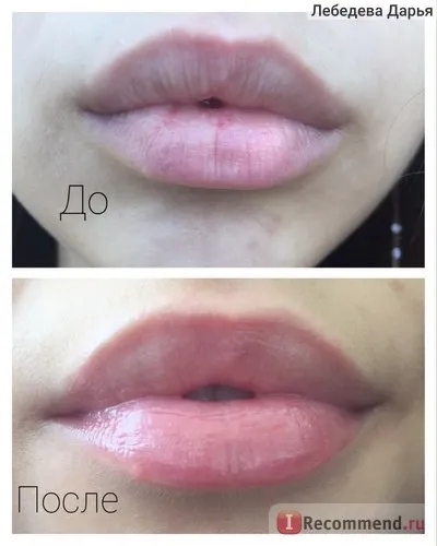 Бальзам для губ almea xlips plumper - «чи може бальзам збільшити губи! », Відгуки покупців (бальзам) Бальзам для губ almea xlips plumper - «чи може бальзам збільшити губи!