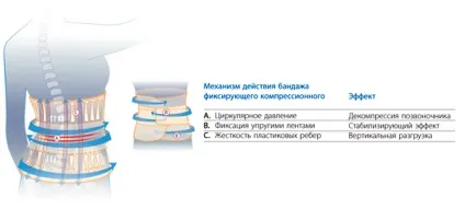Бандаж компресійний фіксує