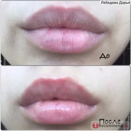 Бальзам для губ almea xlips plumper - «чи може бальзам збільшити губи! », Відгуки покупців (може) Бальзам для губ almea xlips plumper - «чи може бальзам збільшити губи!