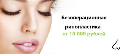 Безопераційна ринопластика - elleclinic (ель клінік) (безопераційна) Безопераційна ринопластика - elleclinic (ель клінік)