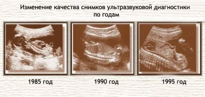Вагітність і пологи в ссср (пологи) Вагітність і пологи в ссср