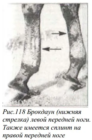 хвороба брокдаун