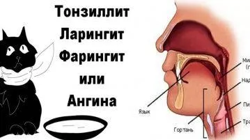 Болить горло, боляче ковтати - чим лікувати в домашніх умовах, що робити дитині, якщо сильно (горло) Болить горло, боляче ковтати - чим лікувати в домашніх умовах, що робити дитині, якщо сильно