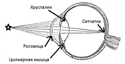 Короткозорість (міопія) - все що потрібно знати - зір на 100 (міопія) Короткозорість (міопія) - все що потрібно знати - зір на 100