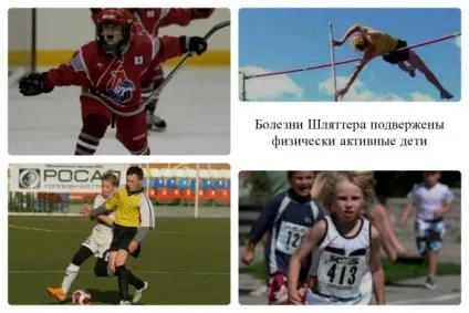 Хвороба Осгуд-Шляттера на відео - як виглядають шишки, викликані хворобою Шляттера, під колінними чашечками (Шляттера) Хвороба Осгуд-Шляттера на відео - як виглядають шишки, викликані хворобою Шляттера, під колінними чашечками