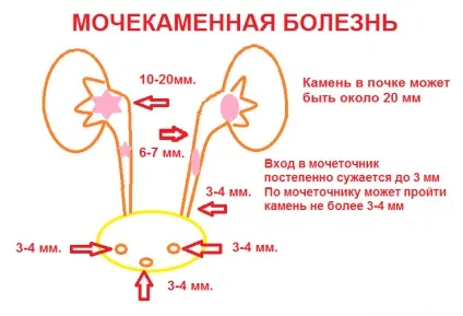 Хвороби сечового міхура у жінок діагностика, симптоми, лікування