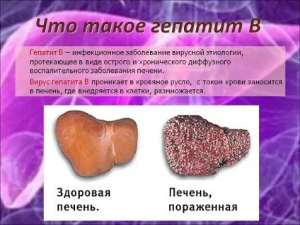 Болить горло, боляче ковтати - чим лікувати в домашніх умовах, що робити дитині, якщо сильно (болить) Болить горло, боляче ковтати - чим лікувати в домашніх умовах, що робити дитині, якщо сильно