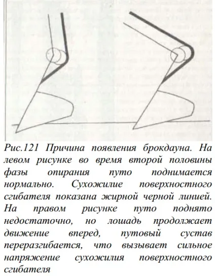 хвороба брокдаун