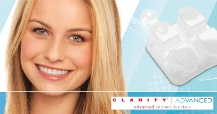 Брекети clarity sl і advanced переваги, ціна, відгуки (брекет-система Кларіто ціна та відгуки) Брекети clarity sl і advanced переваги, ціна, відгуки