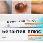 Чим намазатися, щоб не кусали клопи огляд засобів від укусів клопів (кусали) Чим намазатися, щоб не кусали клопи огляд засобів від укусів клопів