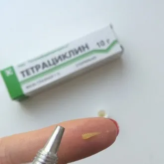 Чим лікувати зовнішній отит вуха у дорослих антибіотики і мазі при зовнішньому отиті (зовнішній) Чим лікувати зовнішній отит вуха у дорослих антибіотики і мазі при зовнішньому отиті