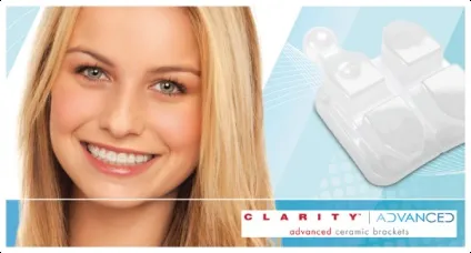 Чим брекети clarity виділяються серед конкурентів (брекети clarity) Чим брекети clarity виділяються серед конкурентів